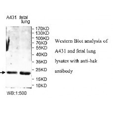 ADAMTS14 Antibody