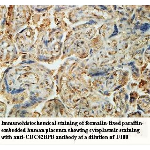 CDC42BPB Antibody