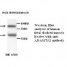 ADAMTS1 Antibody