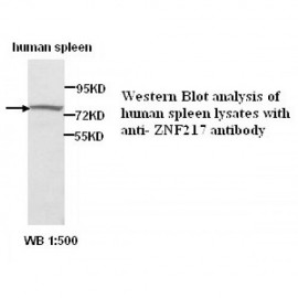 ZNF217 Antibody