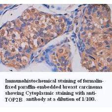 ADAMTS14 Antibody