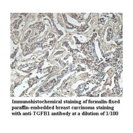 ADAMTS14 Antibody