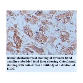 ACAA1 Antibody