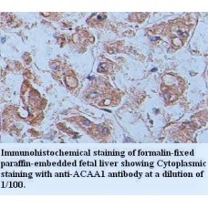 ACAA1 Antibody