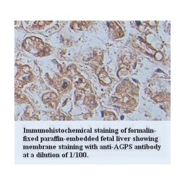 AGPS Antibody