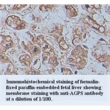 AGPS Antibody