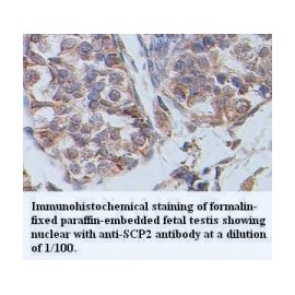 SCP2 Antibody
