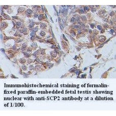 SCP2 Antibody