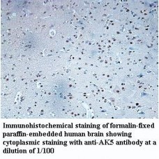 AK5 Antibody