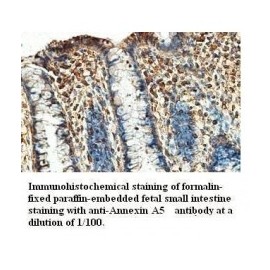 Annexin A5 Antibody