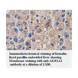 AKR1A1 Antibody