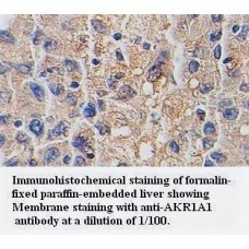 AKR1A1 Antibody
