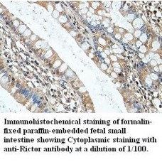 Rictor Antibody