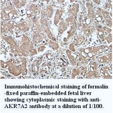 AKR7A2 Antibody