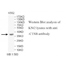 CTSB Antibody