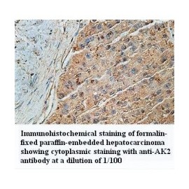 AK2 Antibody