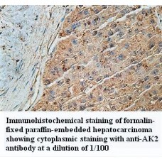 AK2 Antibody