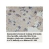 AACS Antibody