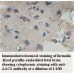 AACS Antibody