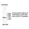 AADACL2 Antibody