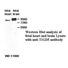 AACS Antibody