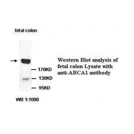AACS Antibody