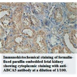 ABCA5 Antibody