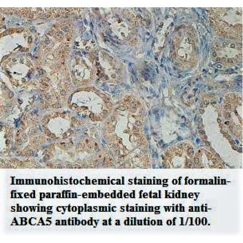 ABCA5 Antibody
