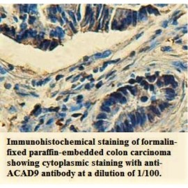 ACAD9 Antibody