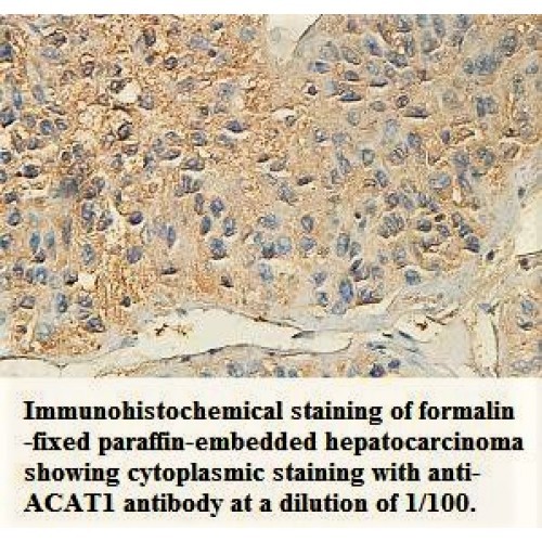 ACAT1 Antibody