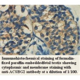 ACSBG2 Antibody