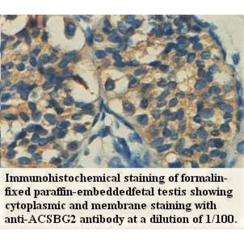 ACSBG2 Antibody
