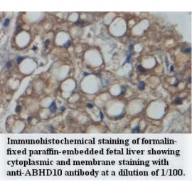 ABHD10 Antibody