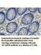 ACADSB Antibody