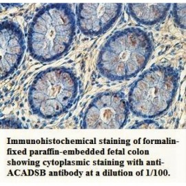 ACADSB Antibody