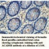 ACADSB Antibody