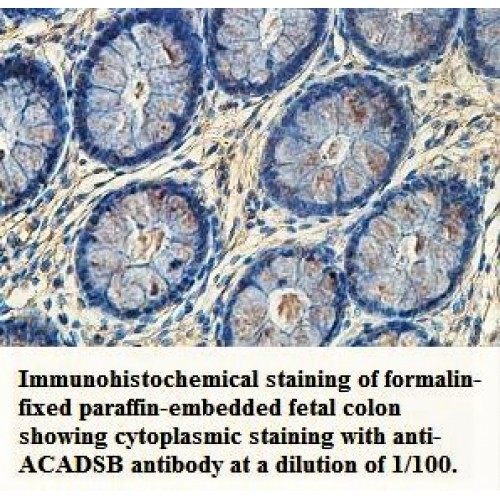 ACADSB Antibody