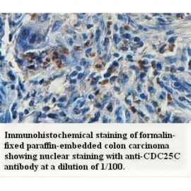 CDC25C Antibody