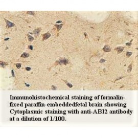 ABI2 Antibody