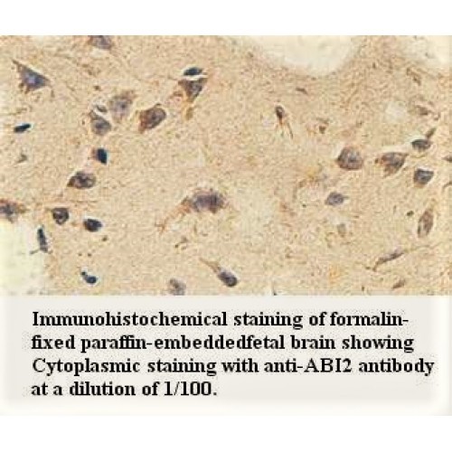 ABI2 Antibody