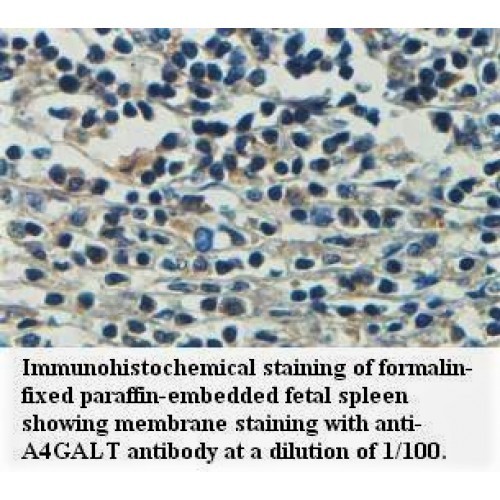 A4GALT Antibody