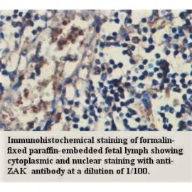 ZAK Antibody