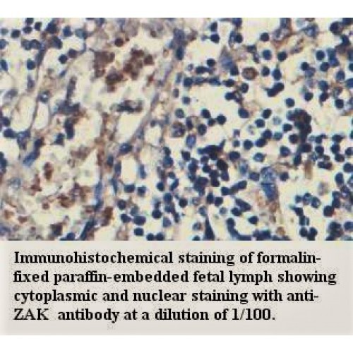 ZAK Antibody