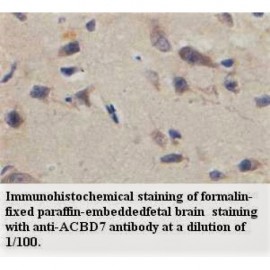 ACBD7 Antibody