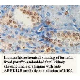 ABHD12B Antibody