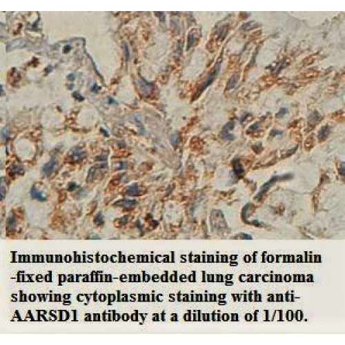 AARSD1 Antibody