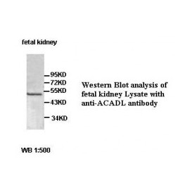 ACADL Antibody