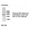 ACADL Antibody