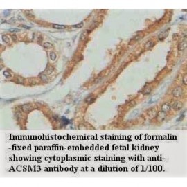 ACSM3 Antibody