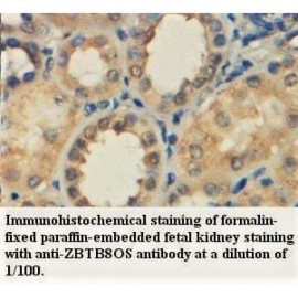 ZBTB8OS Antibody